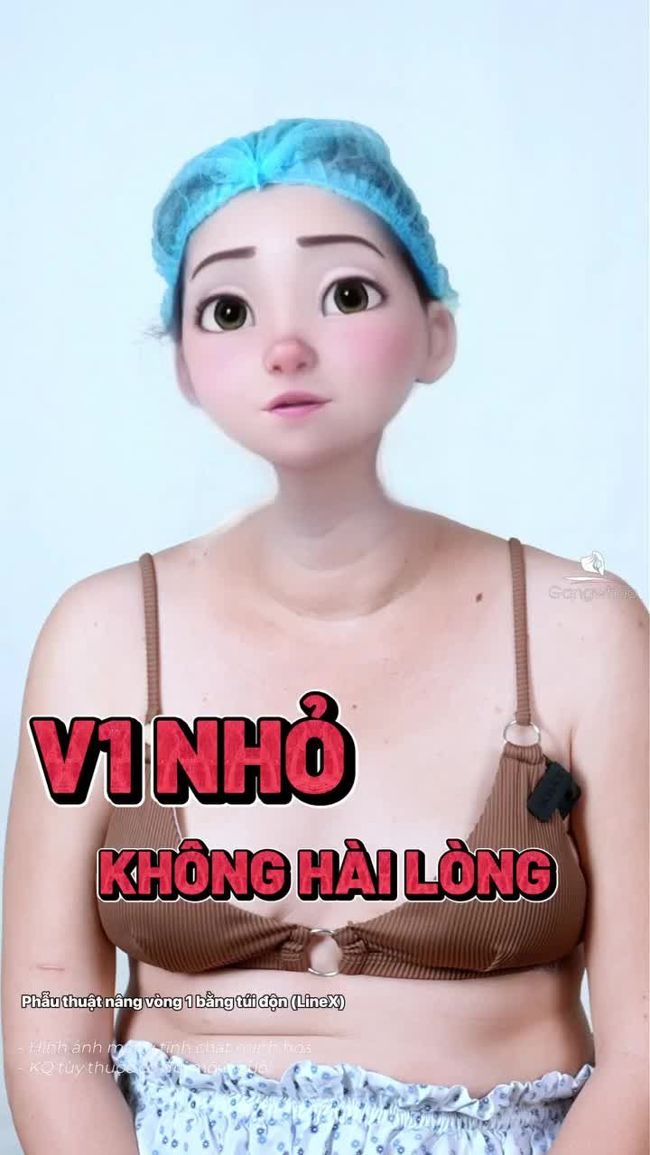 Chị khách hàng thích vòng 1 bự Sau sinh vòng 1 của chị nhỏ, lép nên chị đã quyết định tới Gangwhoo để nâng cấp vòng 1, nâng cấp bản thân mình