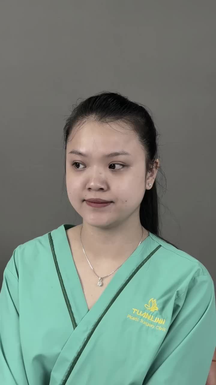 CHIẾC MŨI ''CỨU" NHAN SẮC CẢ GƯƠNG MẶT!!