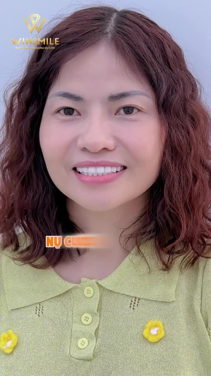 "Cuối cùng chị cũng được giải thoát khỏi nụ cười bị phong ấn..."