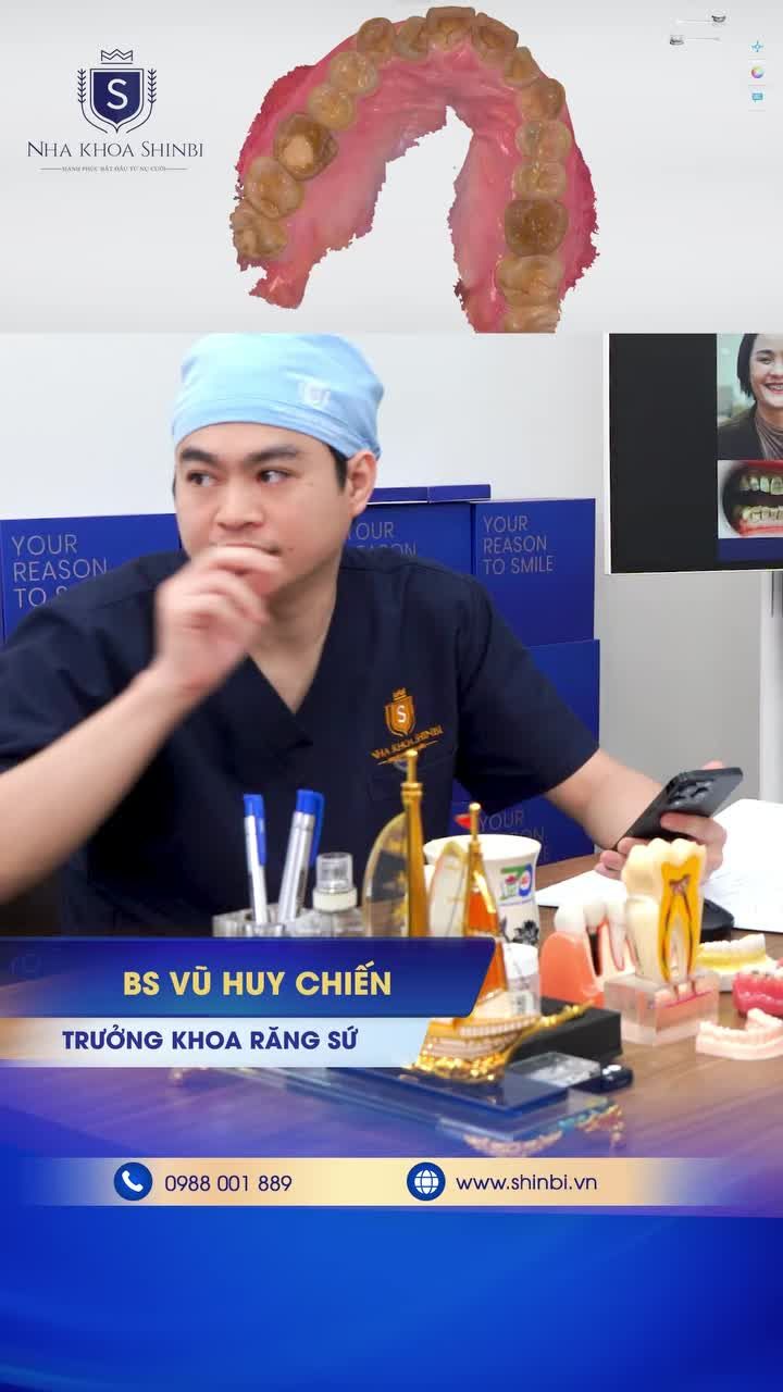 Răng khấp khểnh, cắn chéo – giải pháp là gì?