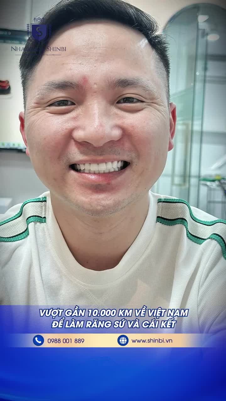 VƯỢT 10.000 KM VỀ VIỆT NAM CHỈ ĐỂ LÀM RĂNG SỨ VÀ CÁI KẾT..!