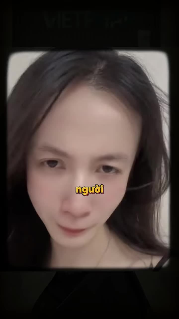 GIAI ĐOẠN "XẤU NHẤT" KHI NIỀNG RĂNG