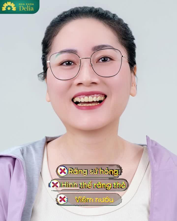 NỐI LẠI NIỀM TIN THẨM MỸ RĂNG SỨ AN TOÀN, CHẤT LƯỢNG CHO KIỀU BÀO