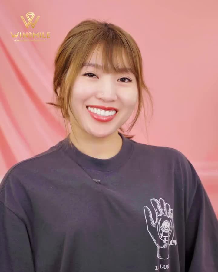 Mỗi nụ cười tại Win Smile là một tác phẩm được thiết kế để tôn vinh vẻ đẹp và thần thái riêng của từng người.
