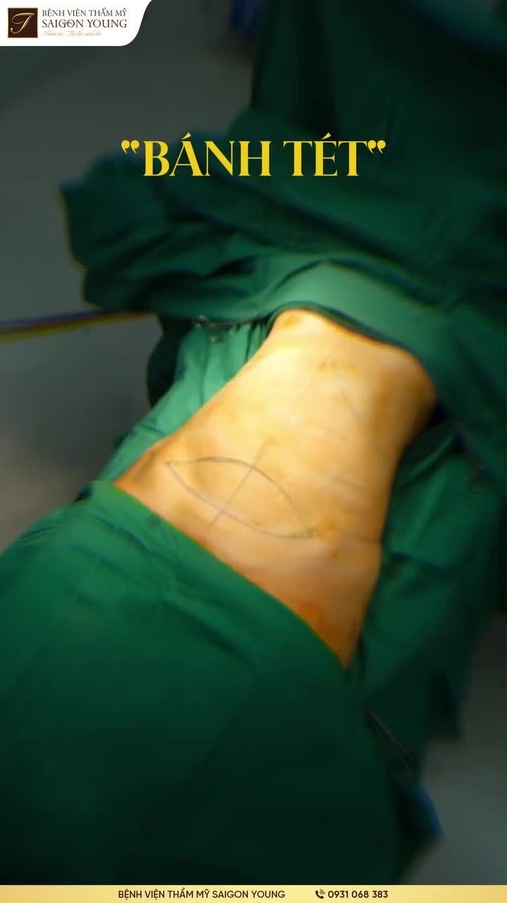 BÁC SĨ TƯƠI THIẾT KẾ VÒNG 2 SIÊU CUỐN