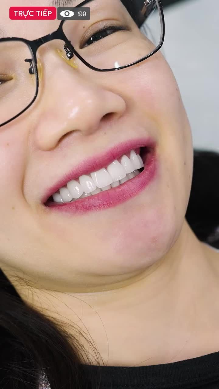 Kết quả thẩm mỹ 20 răng sứ Lava Plus cho cô giáo chuyên Văn tại Delia. Xem ngay!