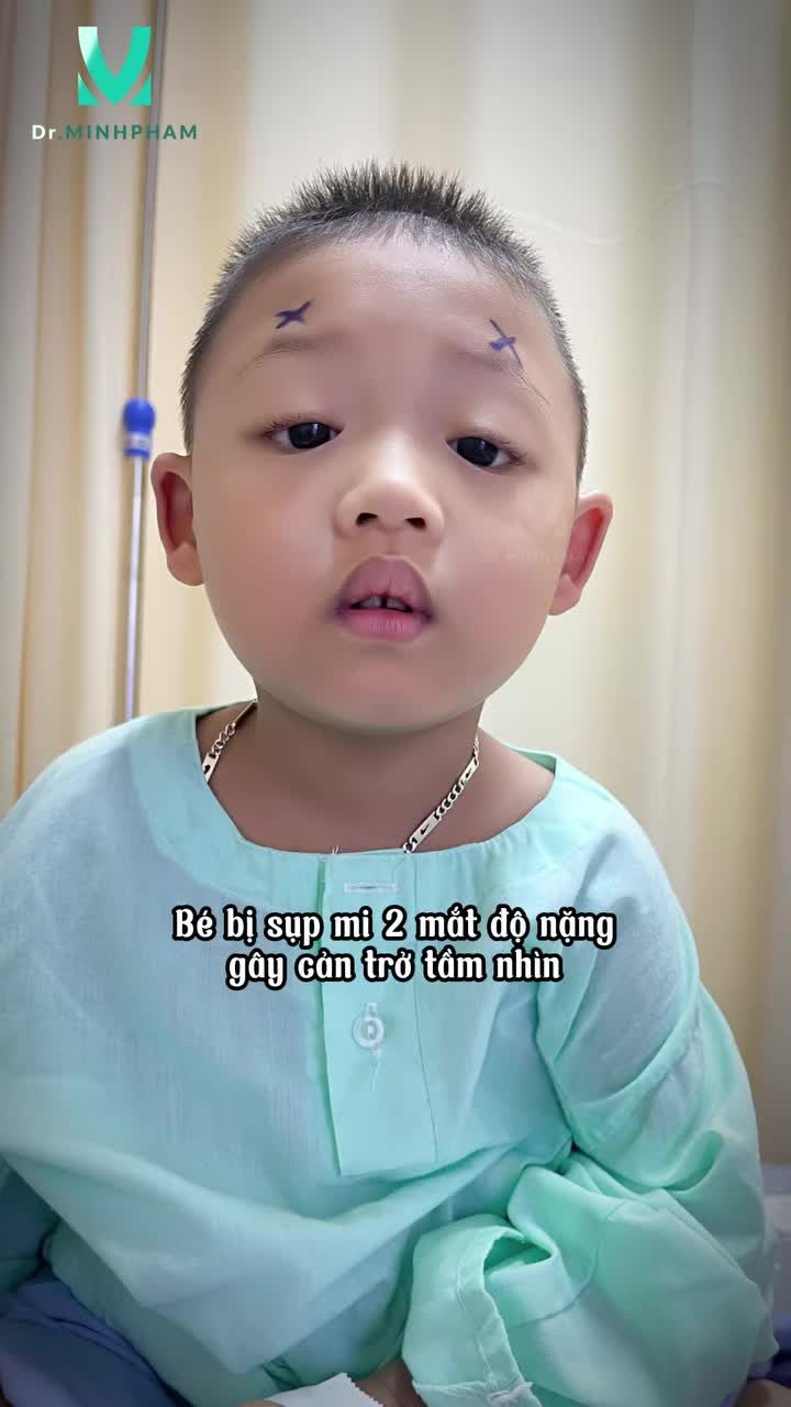 Sự Thay Đổi Sau Phẫu Thuật Sụp Mi Bẩm Sinh Của Bé Quang Thịnh