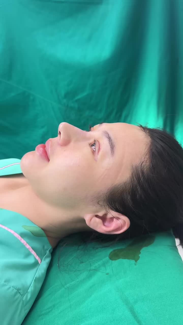 NÂNG MŨI CẤU TRÚC SỬA LẠI CHO KHÁCH HÀNG ĐẾN TỪ VŨNG TÀU - DÁNG MŨI CAO TÂY SANG CHẢNH!