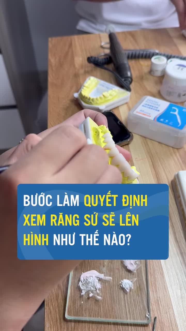 Chế tác răng sứ là bí quyết thẩm mỹ bên cạnh tay nghề chuyên môn của bác sĩ
