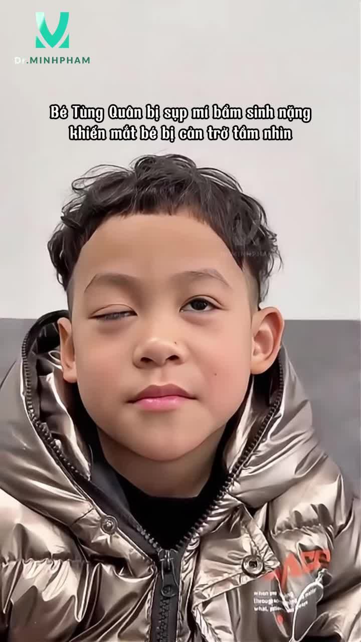 Bé Tùng Quân trước khi đến với Dr. Minh Phạm gặp phải  tình trạng sụp mi bẩm sinh