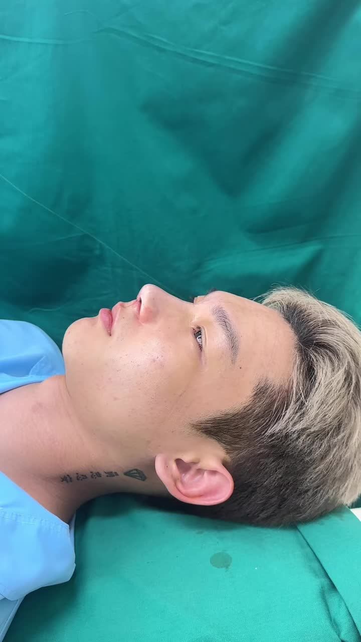 Cấu trúc dáng mũi nam