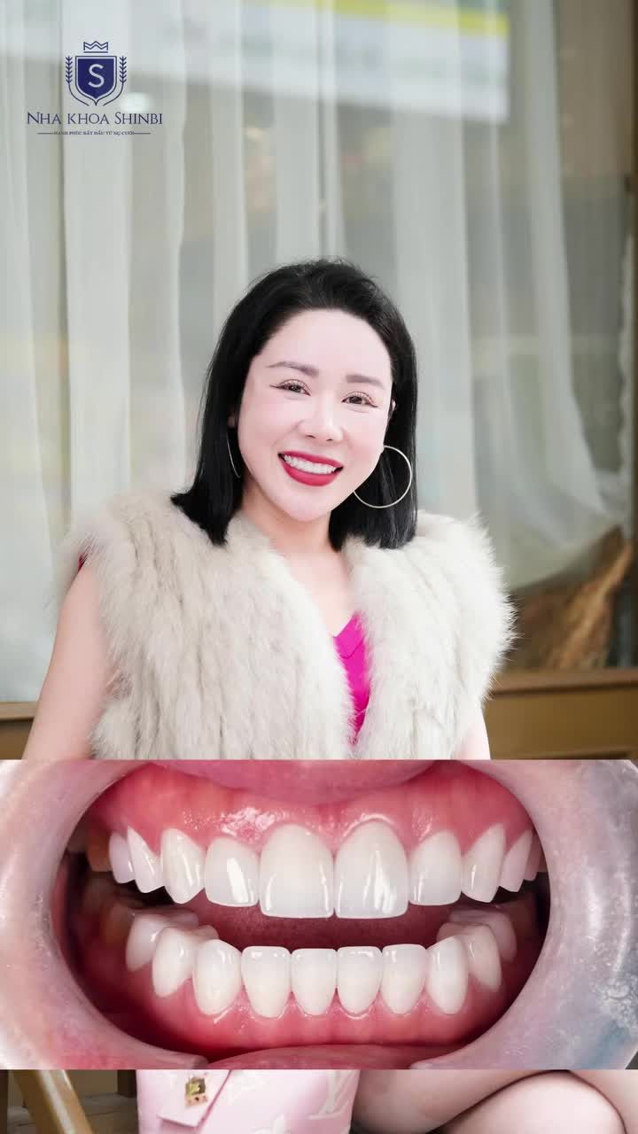 RĂNG SỨ THẨM MỸ CƯỜI ĐẸP HẾT Ý - RẠNG RỠ TỰ TIN