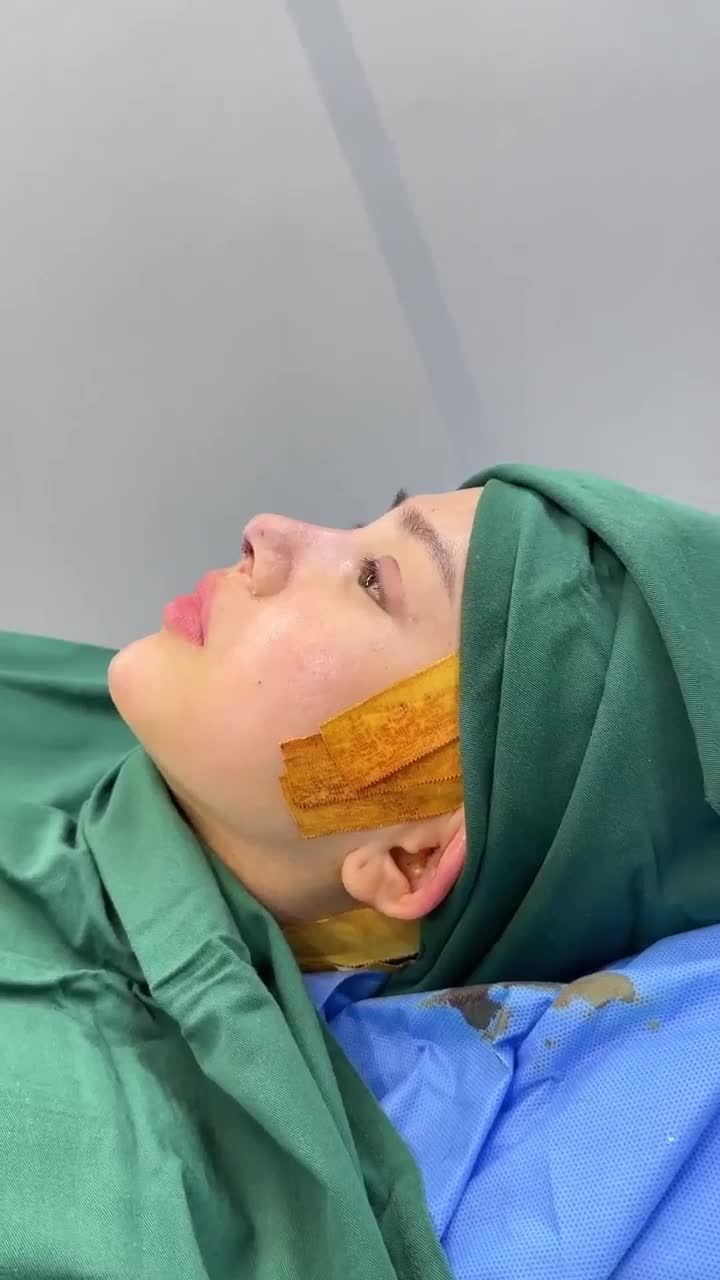 LÊN SÓNG DÁNG MŨI CẤU TRÚC VỪA ĐƯỢC BÁC SĨ HOẠT HOÀN THÀNH!!!