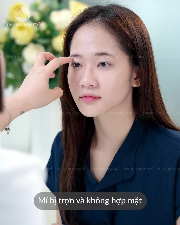 Liệu mình có hối hận khi cắt mí tại Thu Cúc không?