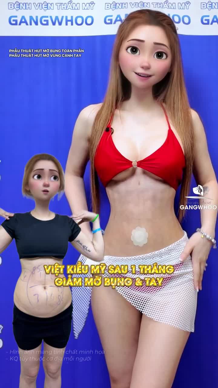 Check body của Việt kiều Mỹ sau 1 tháng giảm mỡ bụng và tay