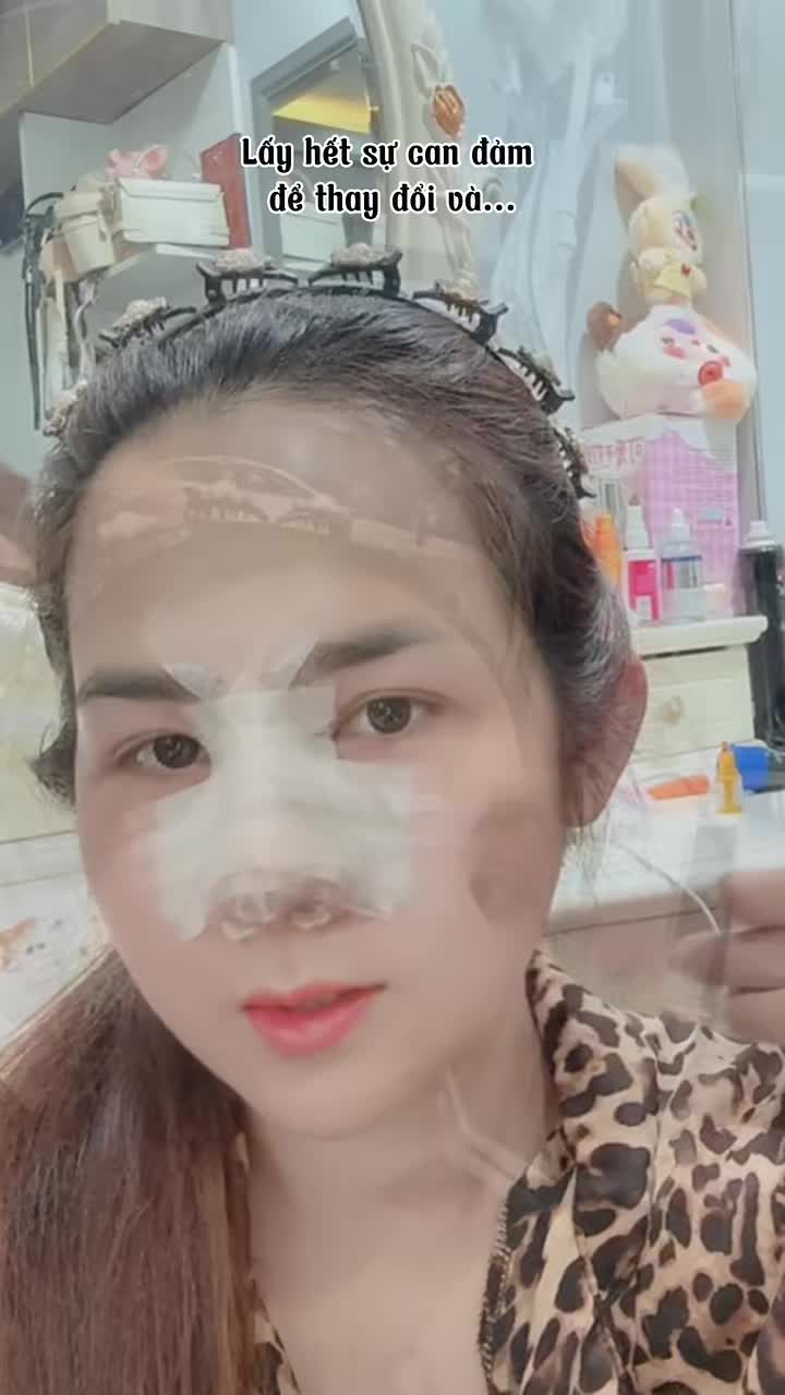 Hậu nâng mũi: Trẻ hơn 10 tuổi Slay hơn 100 lần Hết Tết rồi, nâng mũi đón cơ hội mới trong năm nay thôi chị em!