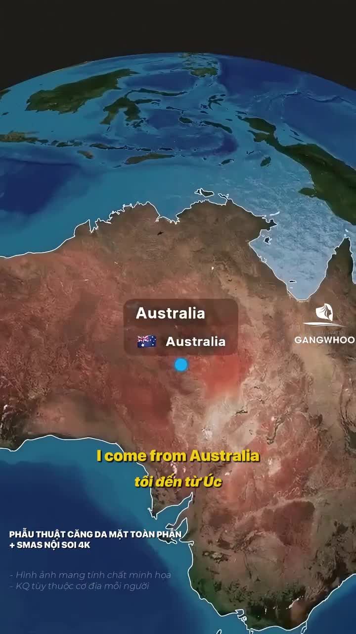 Khách Campuchia sống ở Úc đến Bệnh viện thẩm mỹ Gangwhoo thực hiện Combo trẻ hóa toàn diện với