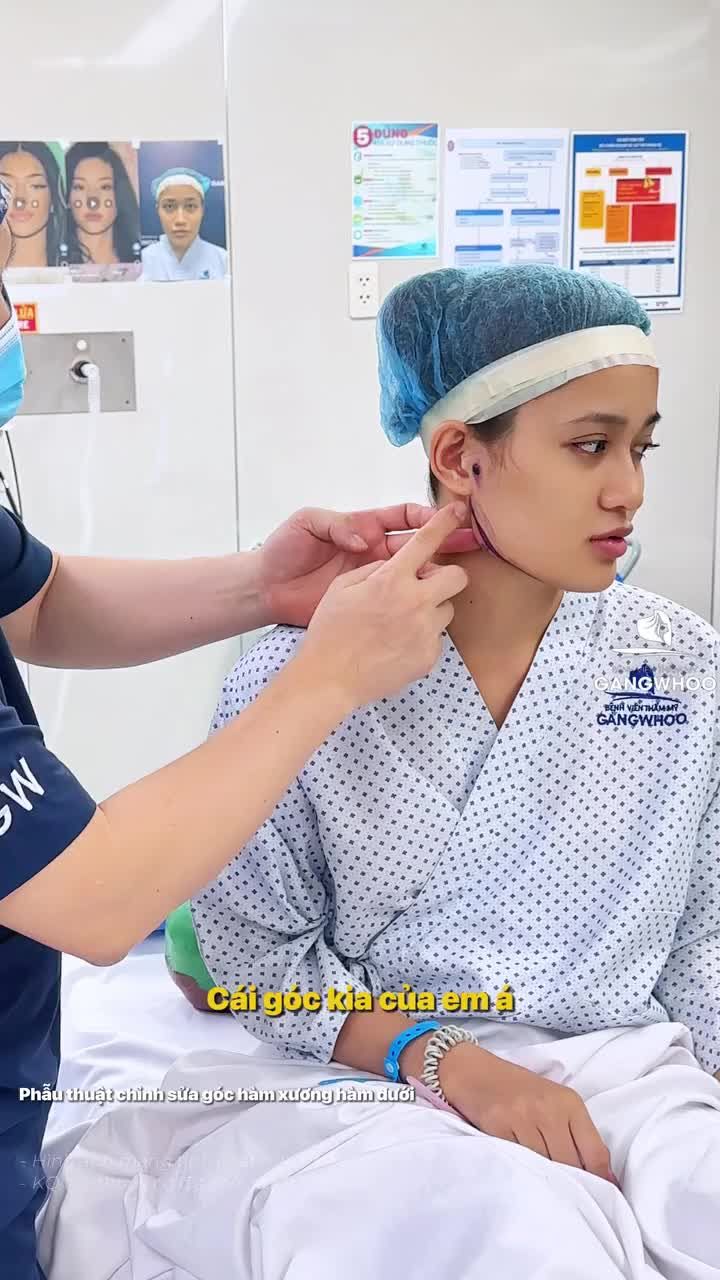 Biến ước mơ từ bé thành hiện thực – góc hàm thon gọn, tự nhiên và đúng với phong cách bạn theo đuổi.