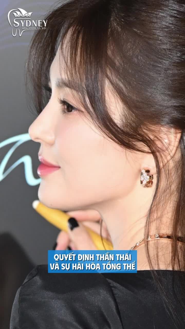 Niềng răng làm thay đổi góc nghiêng như thế nào