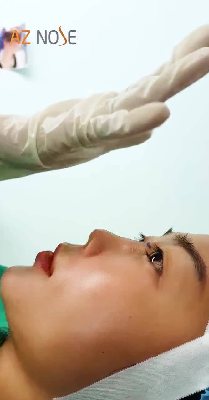 Bạn cần Tái tạo mũi hỏng? Đừng lo! AZNOSE ở đây để giúp bạn tìm lại sự tự tin!