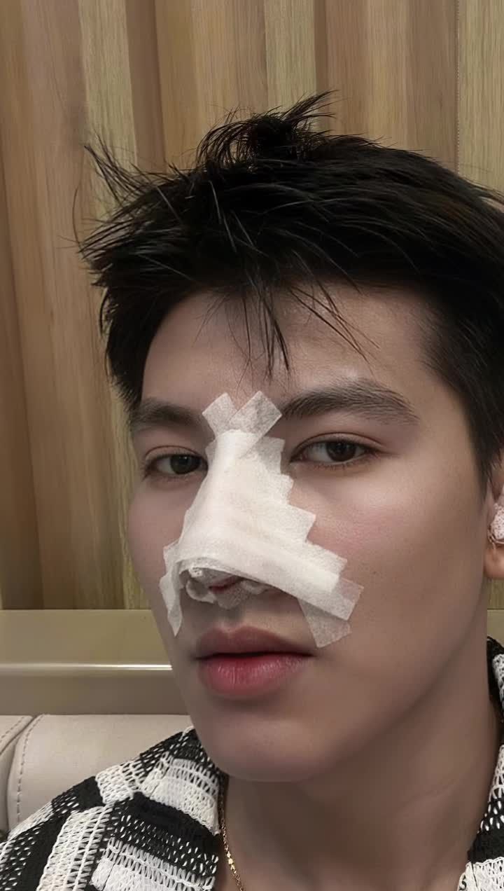 Từ Cambodia, tại sao "hotboy" này lại lựa chọn AZNOSE để cải thiện tình trạng mũi?