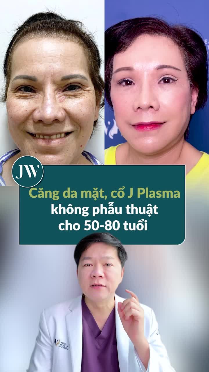 BÁC SĨ TÚ DUNG TẶNG CHỊ EM U50–U80 CÁCH TRẺ HÓA KHÔNG PHẪU THUẬT VỚI J PLASMA