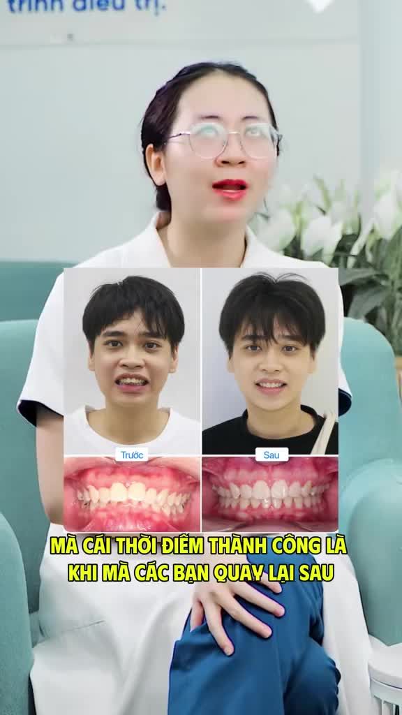 Niềng răng mất bao lâu, yếu tố ảnh ảnh hưởng đến thời gian niềng