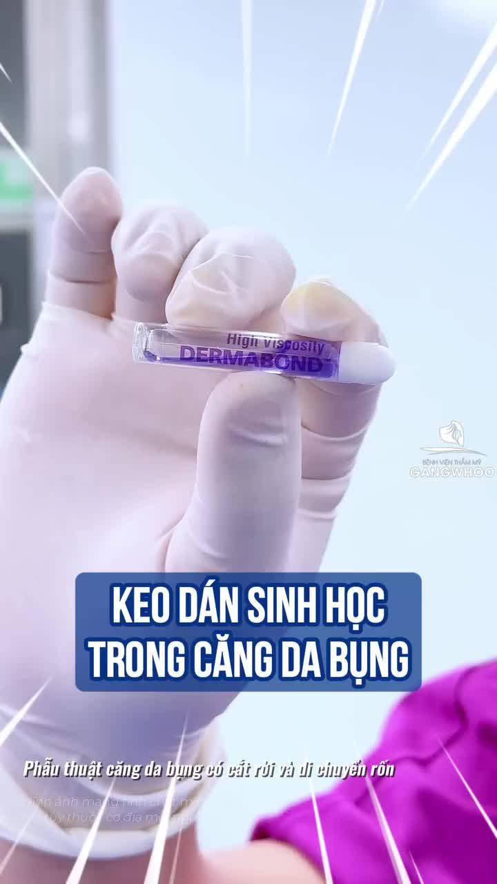 Ứng dụng "keo dán sinh học" trong căng da bụng như thế nào?