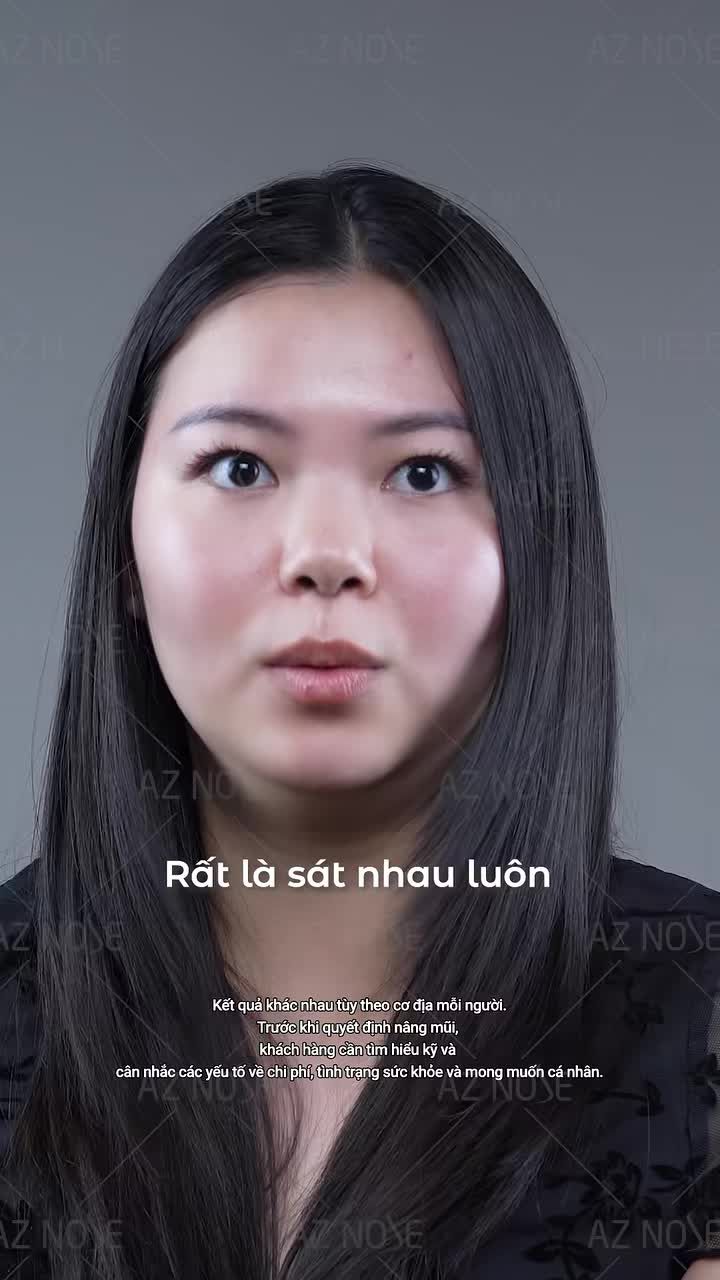 Tại sao GenZ đến từ USA tin chọn AZNOSE để thay đổi dáng mũi - nâng cấp diện mạo?
