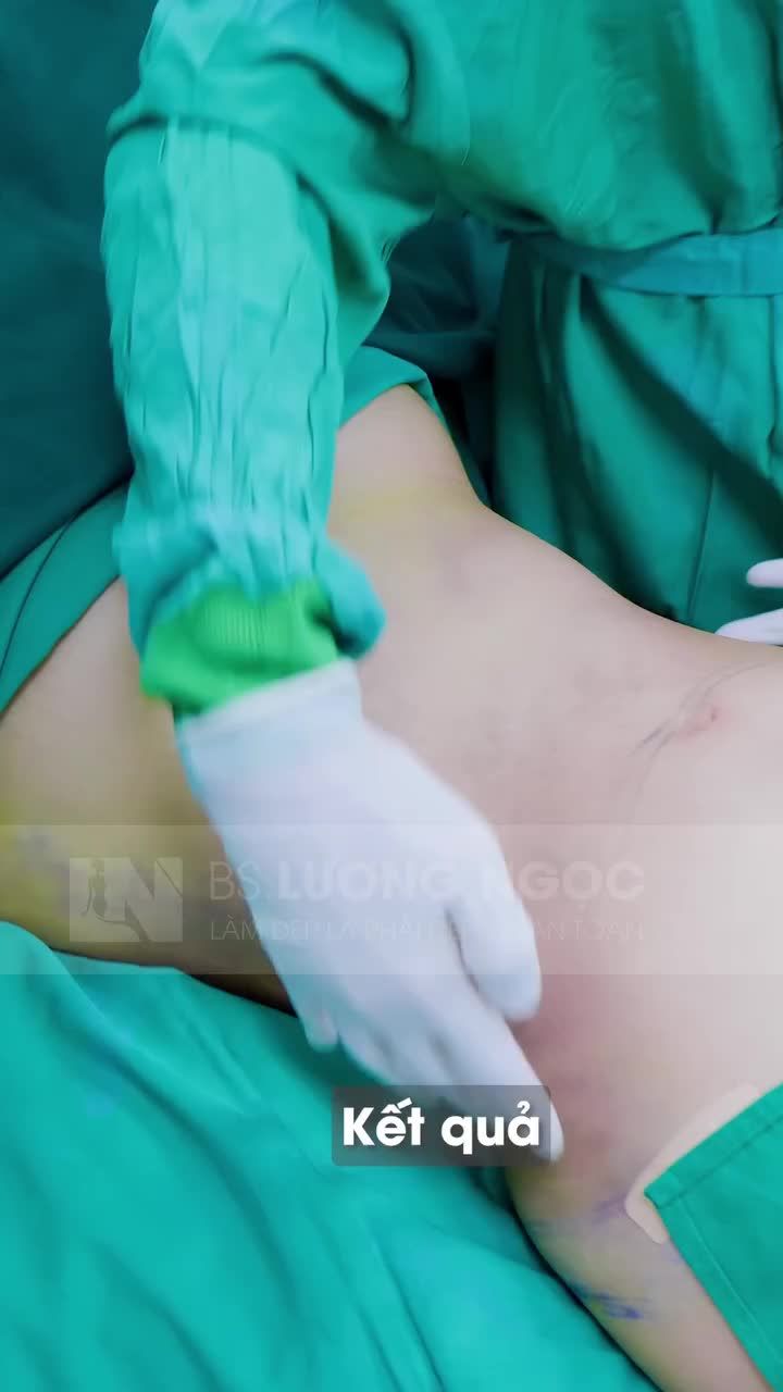 KIẾN TẠO VÓC DÁNG – TỰ TIN ĐÓN HÈ