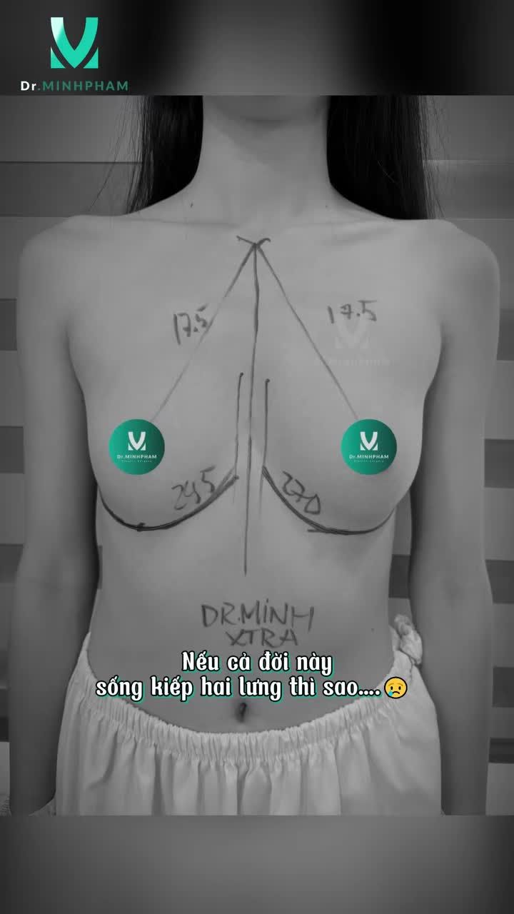 Nếu cả đời này sống kiếp hai lưng thì sao…