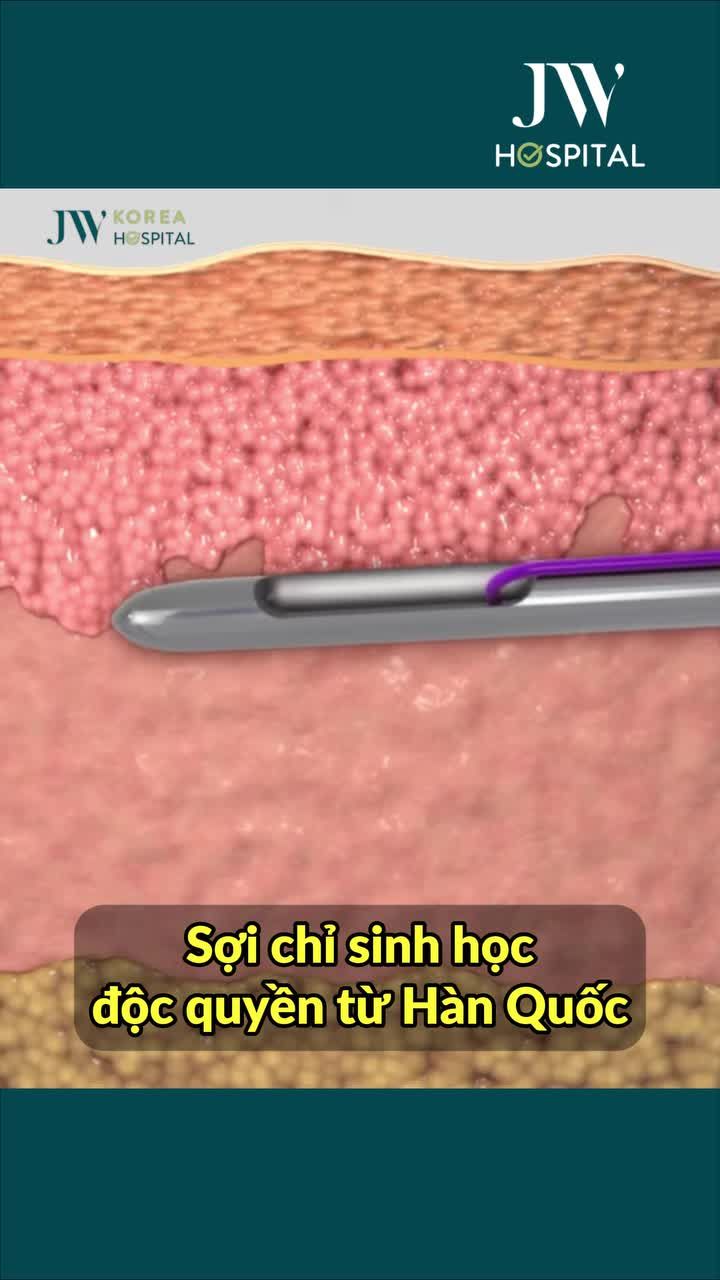 TRẺ 20 TUỔI KHÔNG CẦN PHẪU THUẬT! CÓ THẬT KHÔNG?  MIỄN PHÍ 70% CĂNG DA MẶT BẰNG CHỈ ĐỘC QUYỀN TỪ HÀN QUỐC