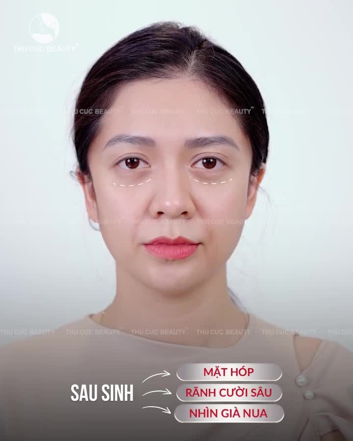 Nỗi lòng của mẹ bìm: Khi nhan sắc "xuống cấp" sau sinh...