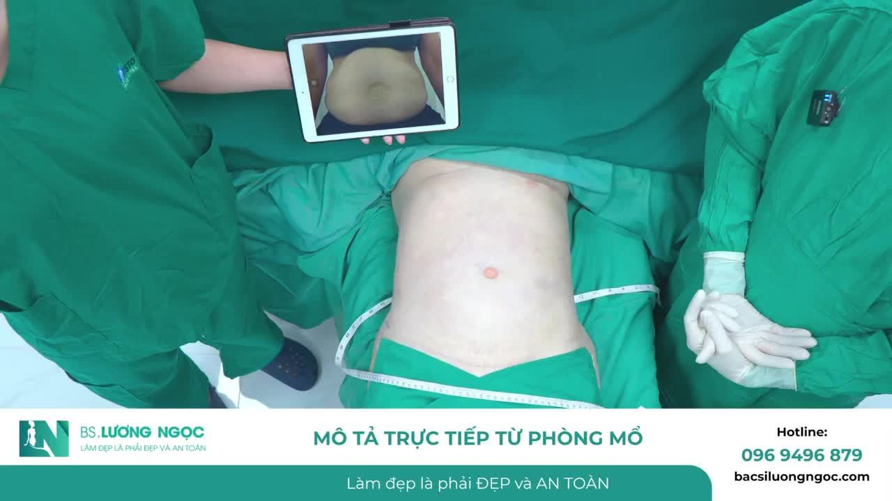 VÒNG BỤNG HƠN 1M GHI NHẬN THAY ĐỔI GẦN 20CM SAU 2 GIỜ THỰC HIỆN