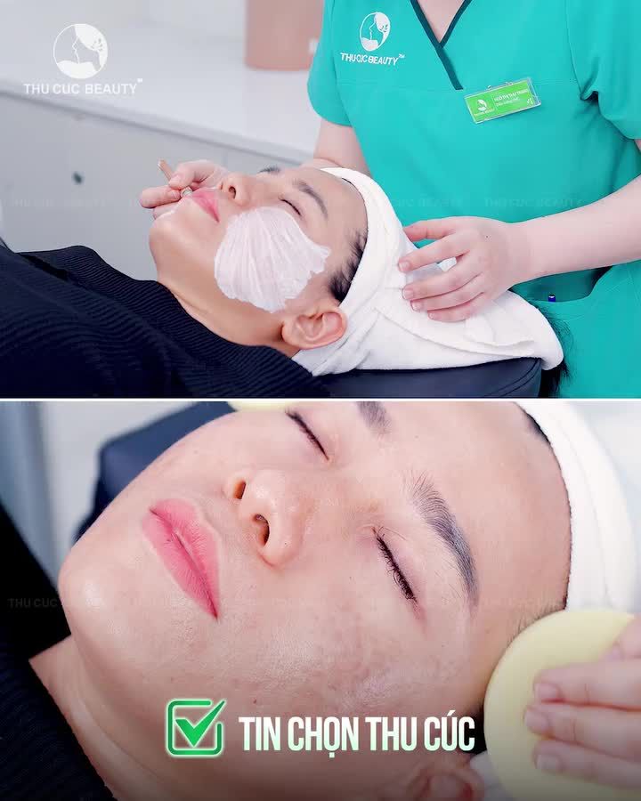 Nám chân sâu, nám mảng có thực sự "hết đường lui"?