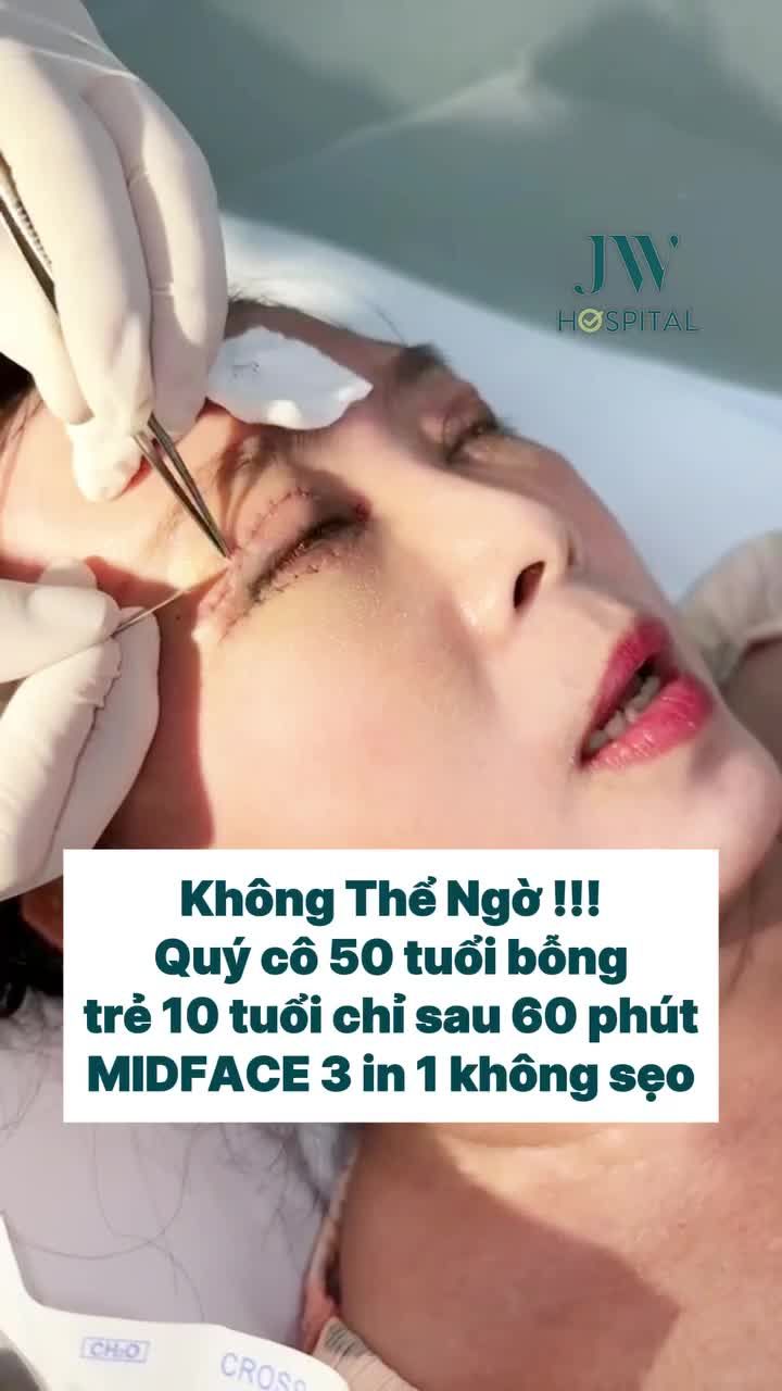 TRẺ HÓA MIDFACE 3 IN 1, HỒI XUÂN 10 TUỔI CHO QUÝ CÔ U50 KHIẾN AI CŨNG BẤT NGỜ
