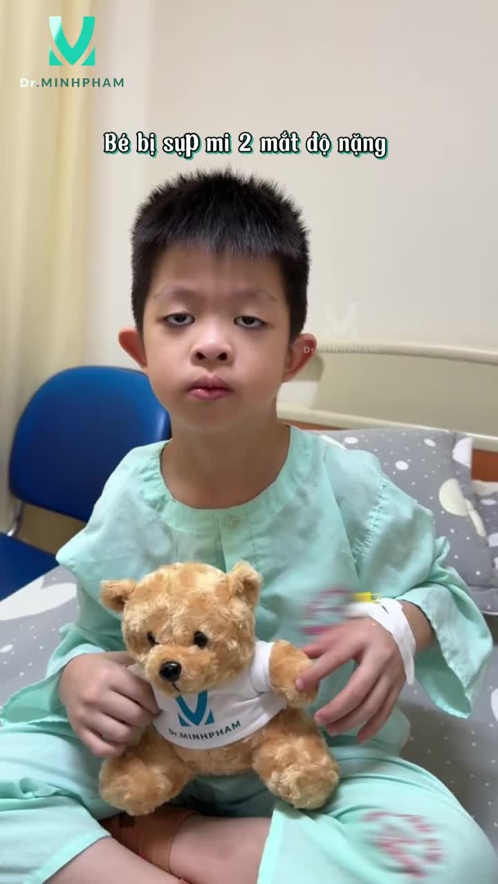 Từng bị sụp mí bẩm sinh khiến ánh nhìn không đều