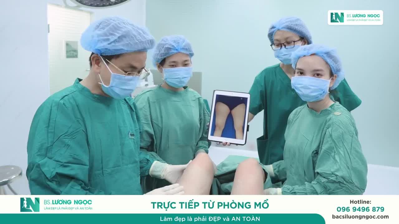 ĐÙI THON GỌN – DA CO MƯỢT MỊN