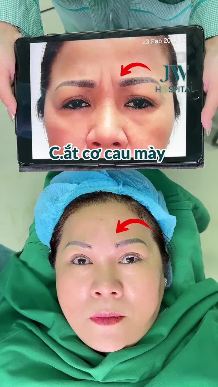 BÁC SĨ TÚ DUNG C.Ắ.T CƠ CAU MÀY KHIẾN CON CÁI KHÔNG CÒN NHẬN RA QUÝ CÔ U60 VÌ TRẺ 10 TUỔI