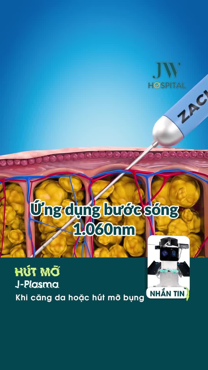 TIN SỐC: JW TẶNG SUẤT 0 ĐỒNG HÚT MỠ KHÔNG PHẪU THUẬT