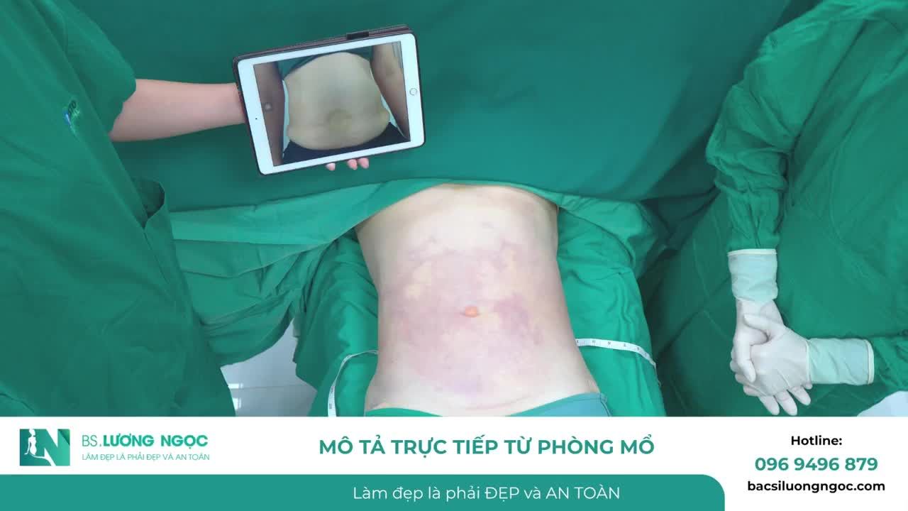 Hành trình cải thiện vòng 2 kém săn chắc, vùng eo ~ 95 cm – theo dõi sự thay đổi rõ rệt chỉ sau 1 giờ 30 phút