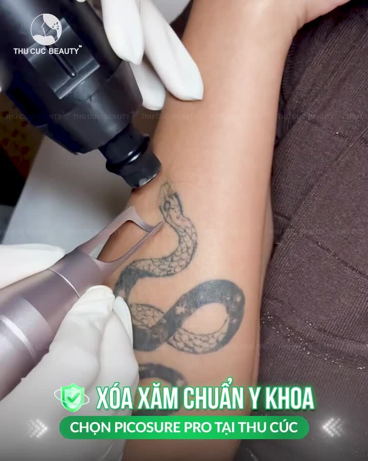 CẬN CẢNH XÓA XĂM VỚI CÔNG NGHỆ LASER ĐỈNH CAO TỪ MỸ