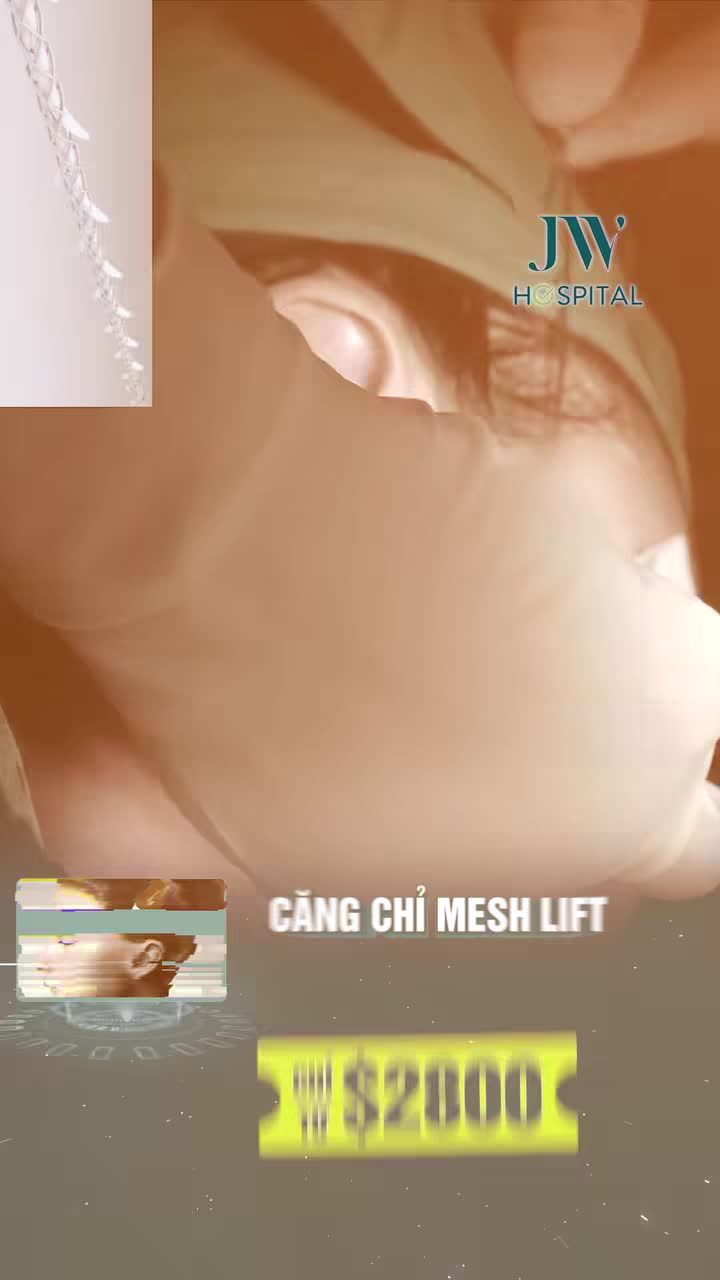 CĂNG CHỈ MESH LIFT KHÔNG PHẪU THUẬT TRẺ 20 TUỔI CHO VIỆT KIỀU - TIẾT KIỆM GẤP 3 LẦN Ở MỸ
