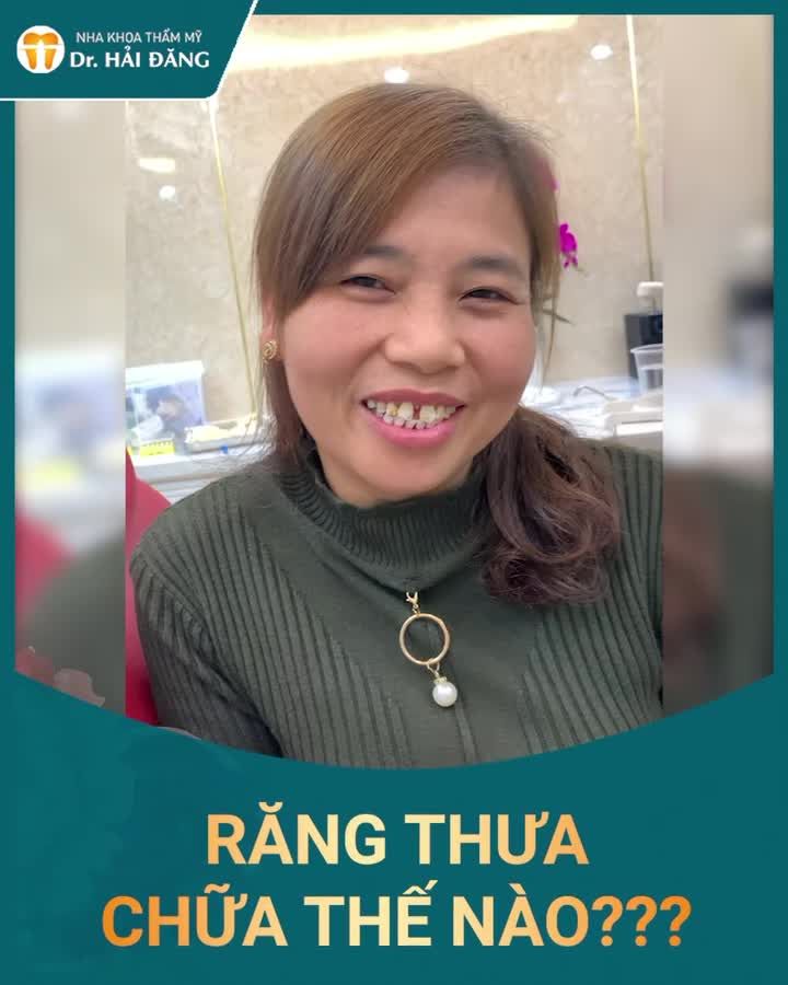 RĂNG THƯA CƯỜI KÉM TỰ TỊ PHẢI LÀM SAO ???