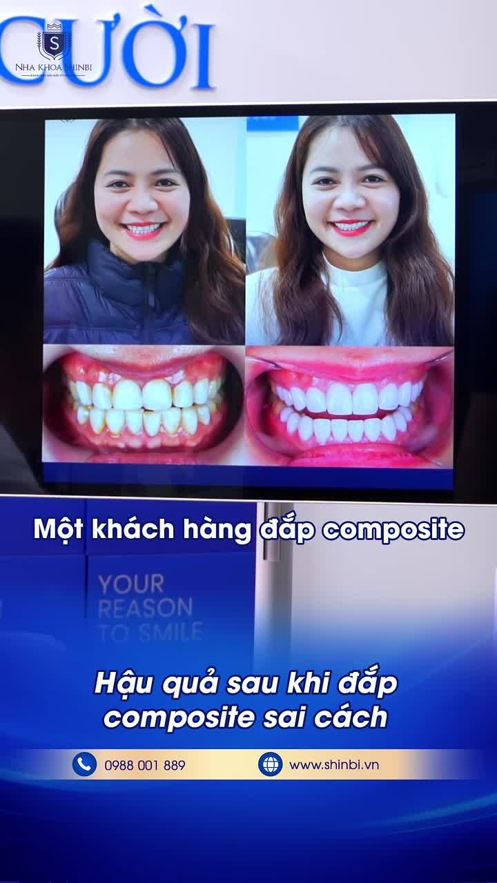 CẢNH BÁO: HẬU QUẢ NGHIÊM TRỌNG KHI ĐẮP COMPOSITE SAI CÁCH TẠI SPA KÉM CHẤT LƯỢNG