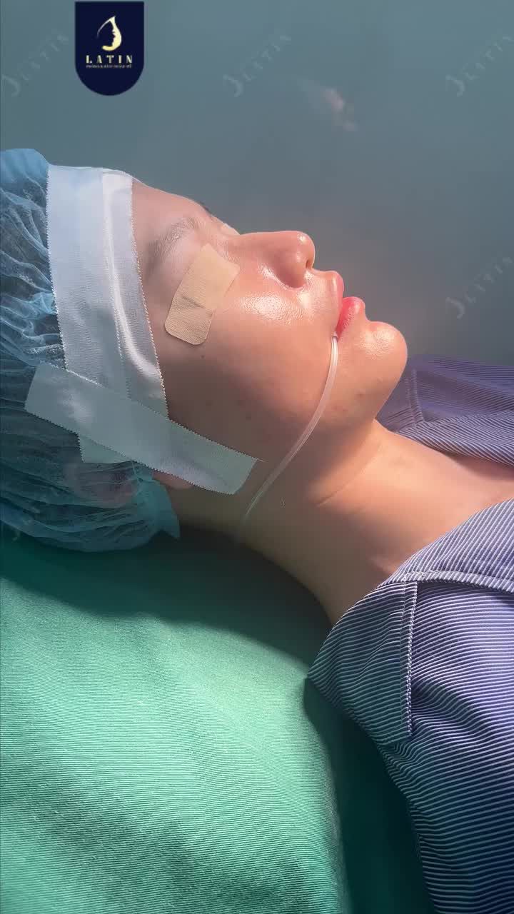 MŨI CAO SẴN NHƯNG THÔ CHỈ CẦN THU NHỎ KHÔNG NÂNG MŨI