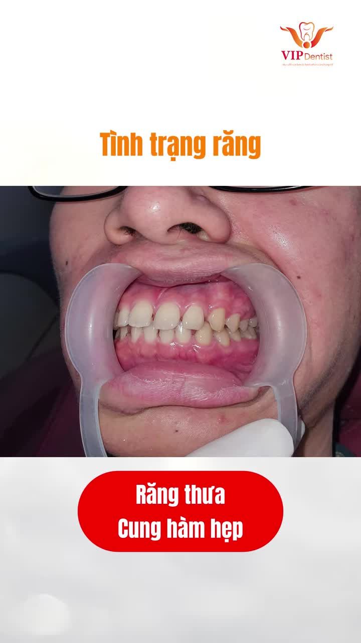 Biến hình với nụ cười chuẩn "Soái ca"!