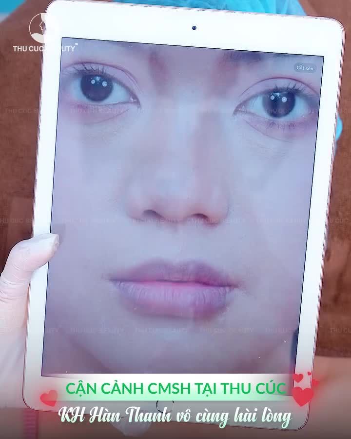 CẤY MÔI SINH HỌC – MÔI CĂNG MỌNG, ĐẸP KHÔNG TÌ VẾT!