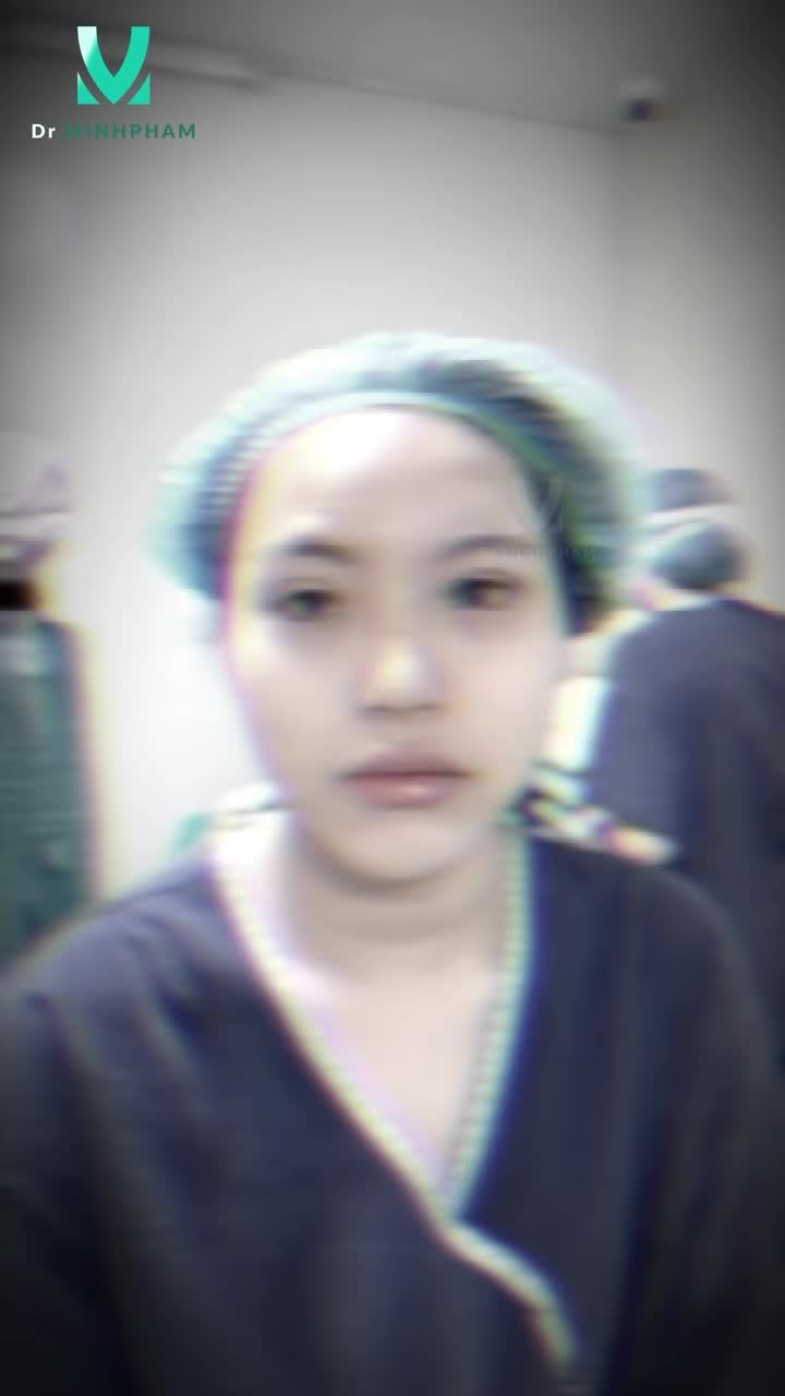 Treo mi VCT – Mở Trọn Ánh Nhìn, Tự Tin Rõ Rệt