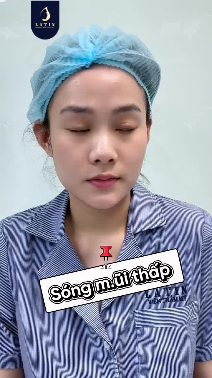 THAY ĐỔI DÁNG MŨI - NÂNG TẦM NHAN SẮC